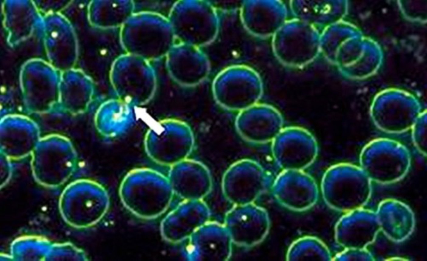 f55119_0fe95f47dbce40cd9f31cd6f206a3a39mv2 Une introduction aux microzymas de Béchamp