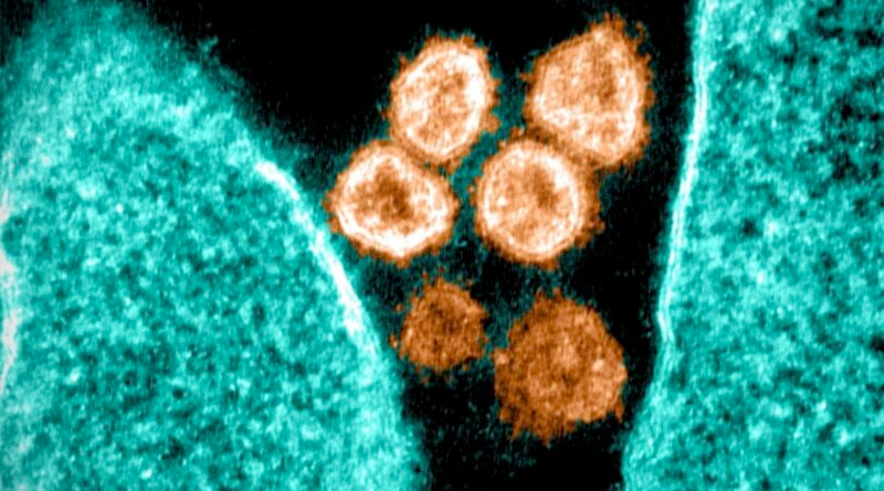 f55119_18419ba0d61a48cb99bd7a6c70ed3ae7mv2 La protéine spike augmente les crises cardiaques et détruit le système immunitaire