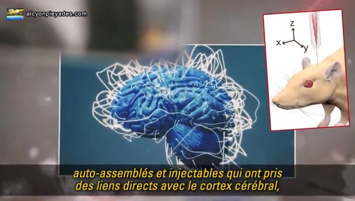 f55119_38f80a00f0804a7ab76878663bd431efmv2 Des médecins italiens témoignent de la présence d’oxyde de graphène dans le sang des vaccinés