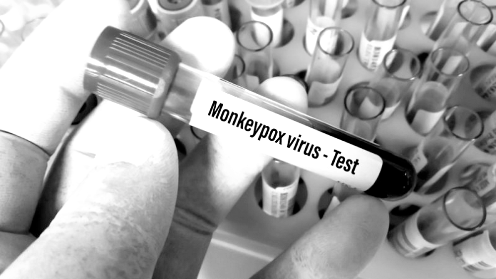 f55119_4ae7972f141c418b88bedce4df30f611mv2 Une étude portugaise révèle l'origine "en laboratoire" du virus de variole du singe (ANGLAIS)